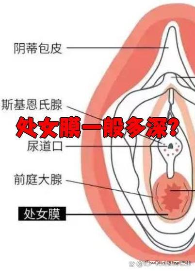 隐空间位置保护在哪